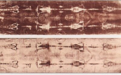 How Did the Shroud of Turin Get Its Image? (Hint: Think Radiation.)